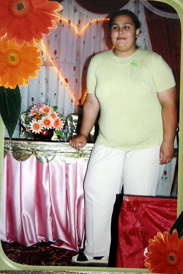 Zayıflamak isterken hayatını kaybetti